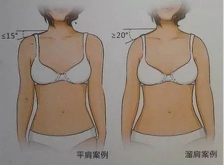 女星争相露肩，杨颖、刘诗诗竟把刘亦菲秒成渣？