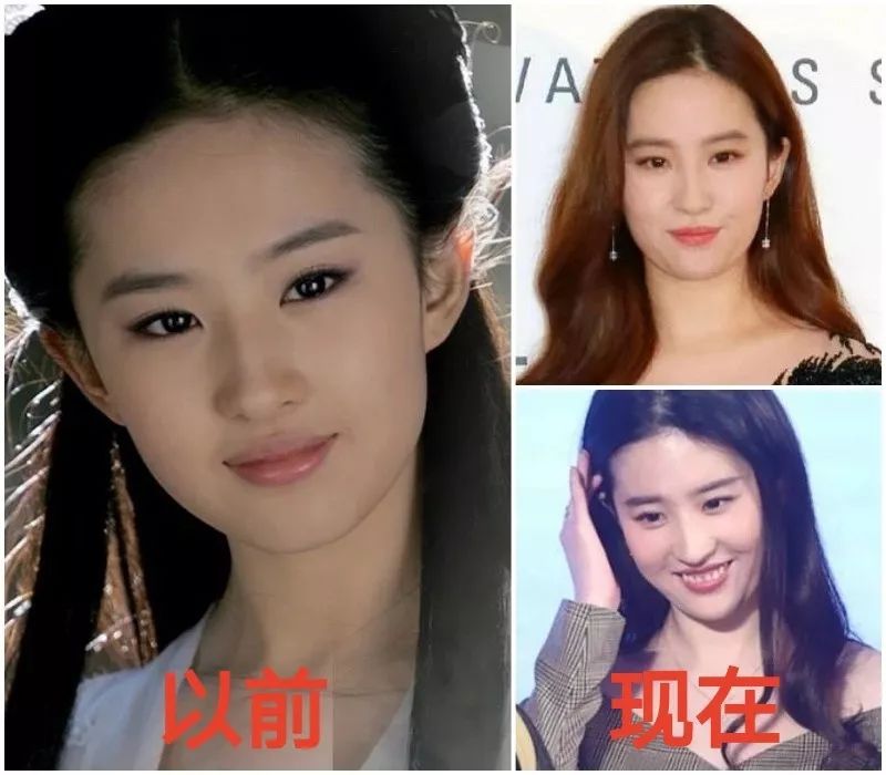 扯白||为什么别人能胖,就是刘亦菲不能胖?